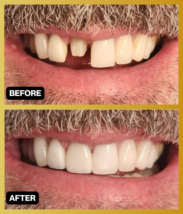 Before and after smile makeover case 3 from Dr. Ghasri’s practice